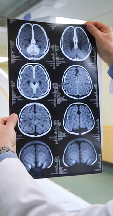 How To Deal With the Insurance Company After a Traumatic Brain Injury